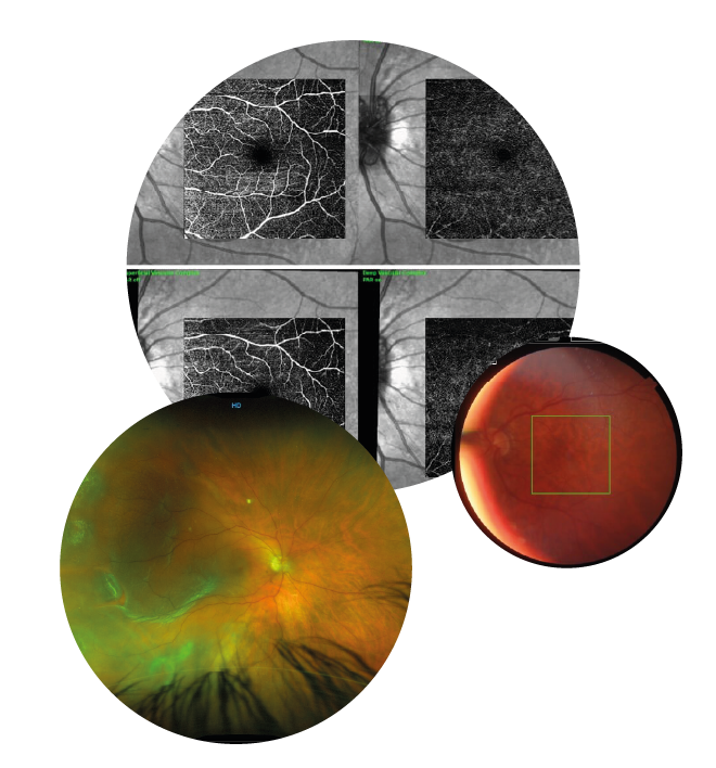 collage foto corazza